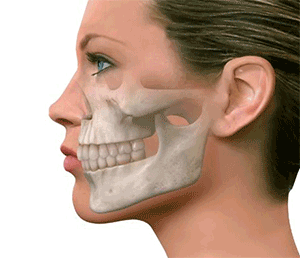 Mordida Cruzada Anterior