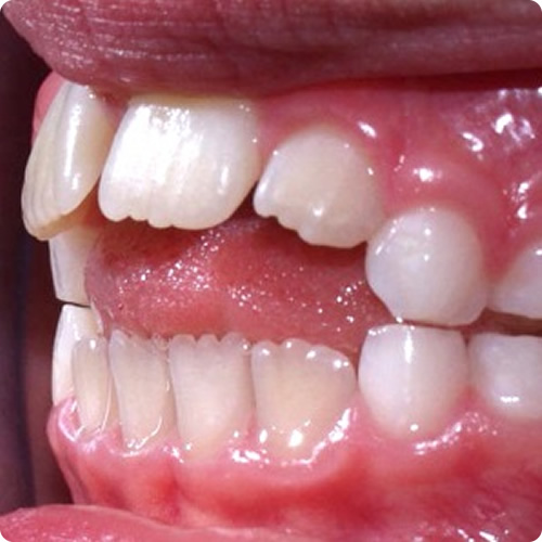 Alterações nas arcadas dentárias - Francisco Stroparo Ortodontia