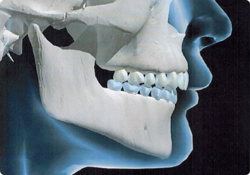 Análise das Bases Ósseas no Sentido Anteroposterior - Francisco Stroparo Ortodontia