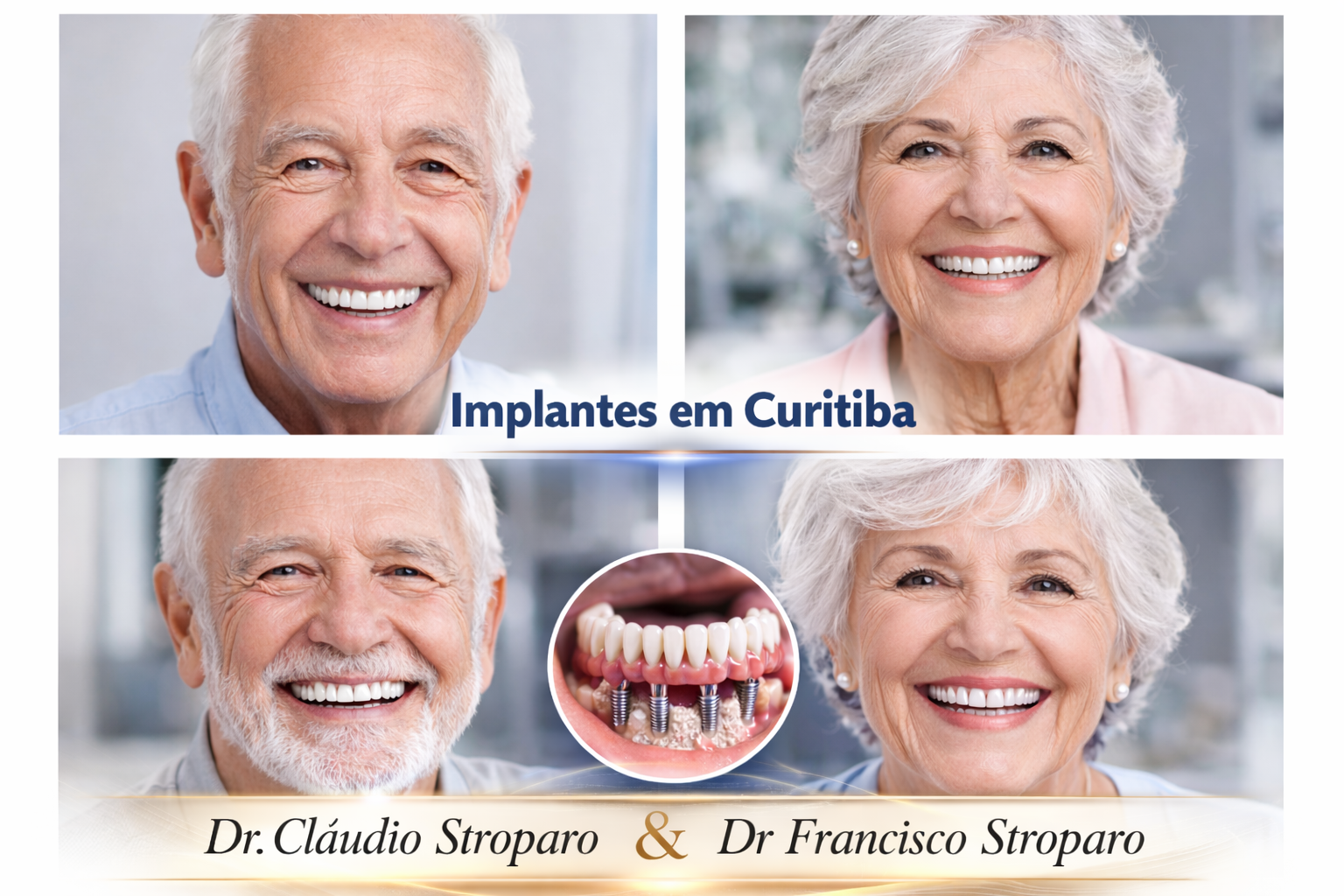 Implantes dentario na terceir idade