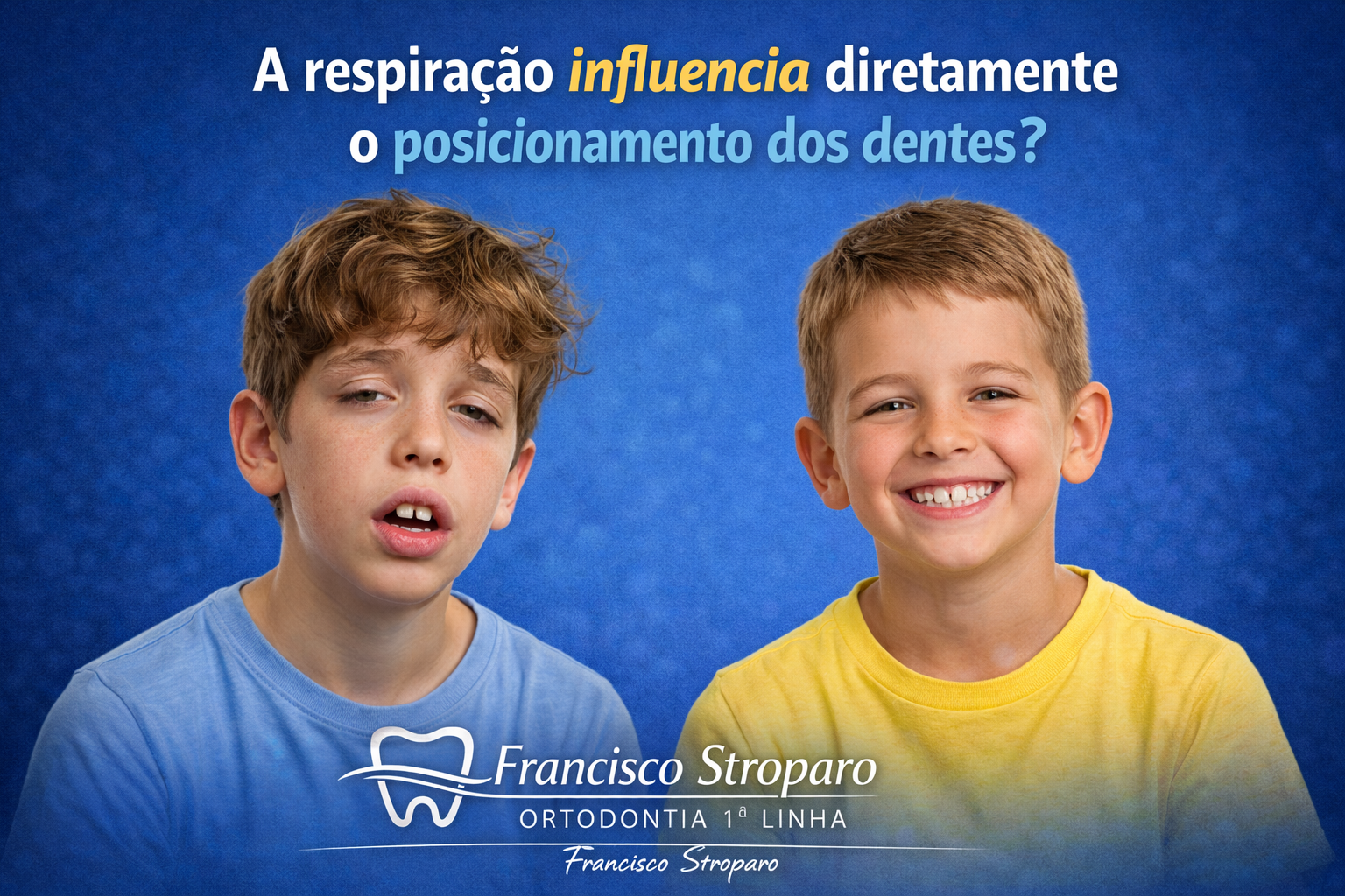 Respiração bucal influencia o posicionamento dos dentes em crianças