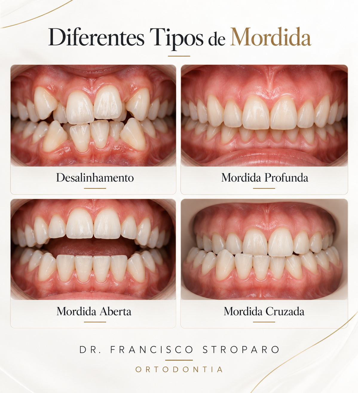 diferentes tipos de mordidas